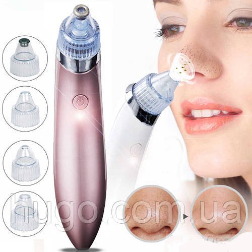 Вакуумний апарат для чищення пор Beauty Skin Care Specialist XN-8030, Рожевий / Вакуумний очищувач пор обличчя