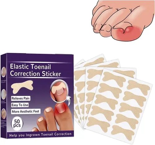 Набір пластирів Elastic Toenail Correction Sticker для корекції та усунення врослих нігтів (50 шт.) HP227
